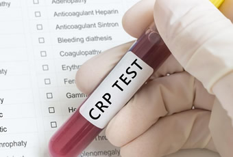 crp test