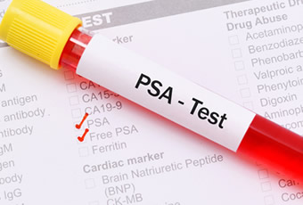 psa test